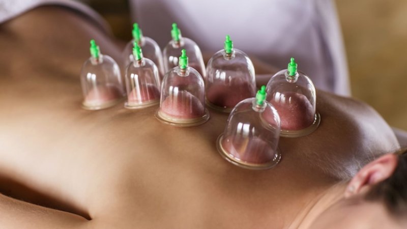 Cupping Course Holistic Therapy Certification Training